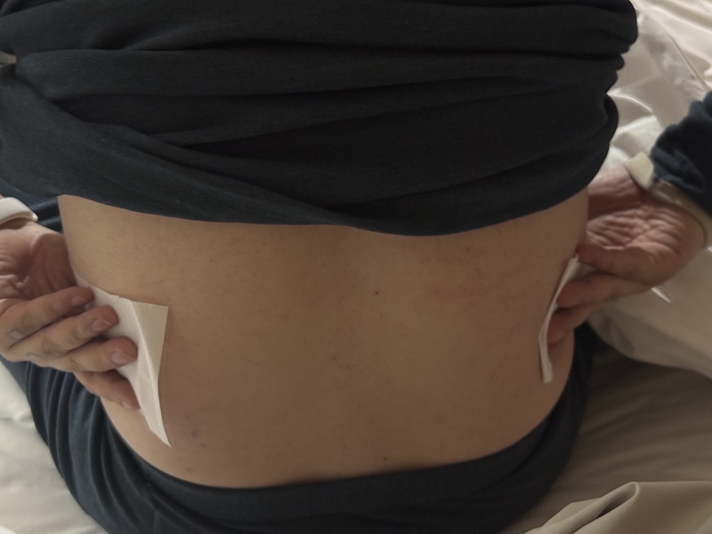 无法环绕的暖腰贴